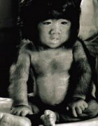 于震寰小时候浑身是毛的老照片，他为什么不脱毛？