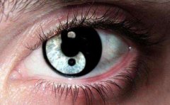 阴阳眼是一出生就有吗，阴阳眼是不是一种病？